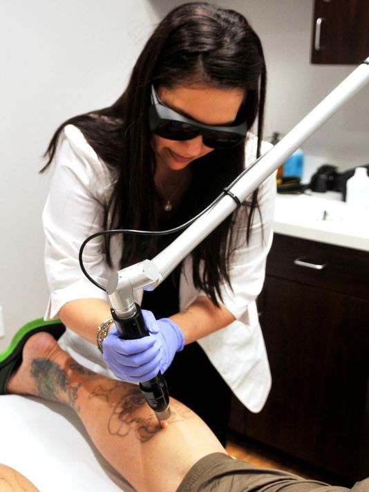 Détatouage